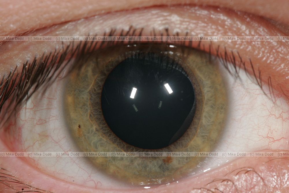 Human eye close-up showing eyelashes white of the eye iris and pupil