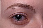 Eye