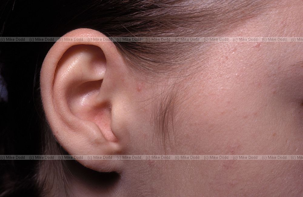 Gosia's ear