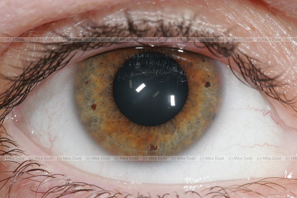Human eye close-up showing eyelashes white of the eye iris and pupil