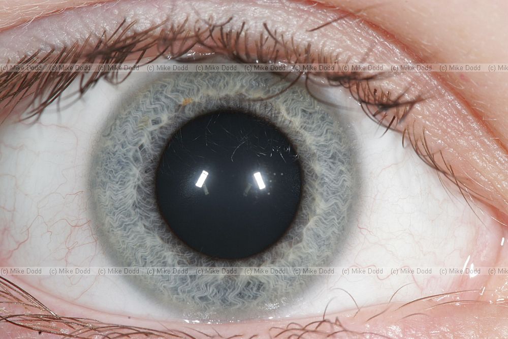 Human eye close-up showing eyelashes white of the eye iris and pupil