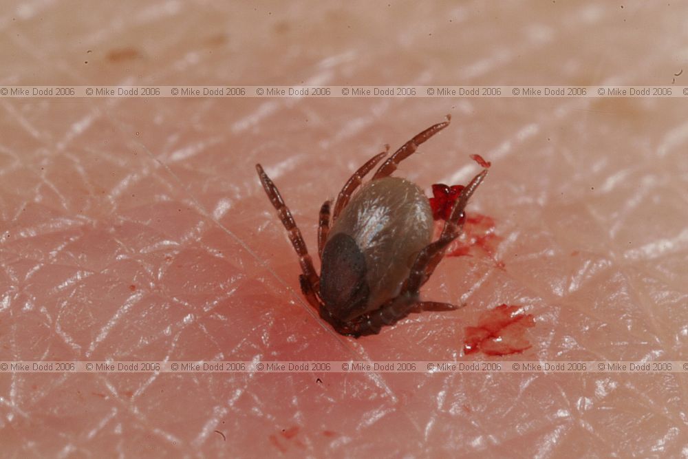 Ixodes ricinus sheep tick (?)  tick in Irina's arm