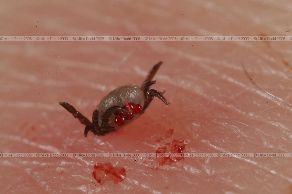 Ixodes ricinus sheep tick (?)  tick in Irina's arm